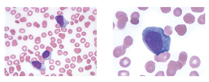 Editorial Utilization And Interpretation Of Epstein Barr Virus 