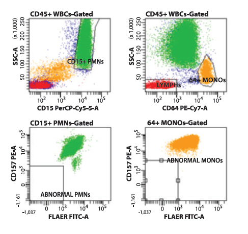 Warde Medical Laboratory: A National Reference Laboratory - Flow cytometry histograms showing normal (Type I) cells on CD157/FLAER PNH analysis.