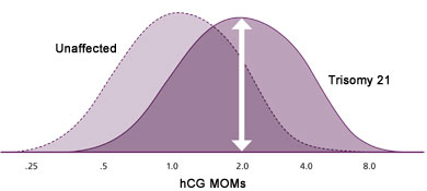 Figure 1A.  hCG MOMs in unaffected pregnancies and those with Trisomy 21 (Down syndrome).