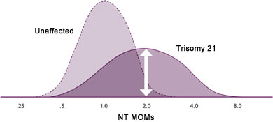 Figure 1B. NT MOMs in unaffected pregnancies and those with Trisomy 21 (Down syndrome).