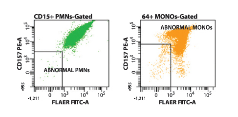 Warde Medical Laboratory: A National Reference Laboratory - Figure 2. Flow cytometry histograms showing the presence of a type II (partially GPI-deficient) PNH-type clone on CD157/FLAER PNH analysis.