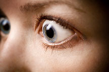  Graves' ophthalmology (bulging eyes)