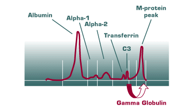Middag eten Millimeter Voordracht Consensus Guidelines for Evaluating Monoclonal Gammopathies - Warde Medical  Laboratory